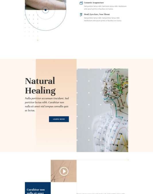 Acupuncture
